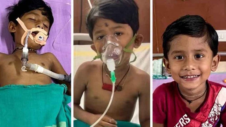 छत्तीसगढ़-रायगढ़ में करैत के डसने से मरणासन्न हुआ मानविक, डॉक्टरों ने बचाई जान